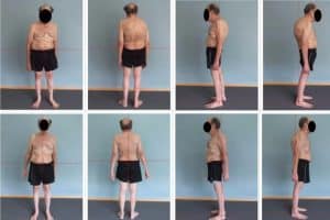 specifieke doelgroepen ouderen